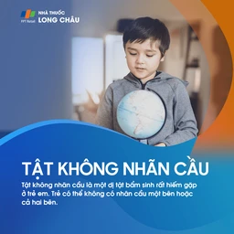 Tật không nhãn cầu 1