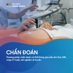 Tật không nhãn cầu 4