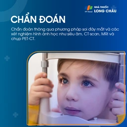 U nguyên bào võng mạc 6