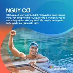 Viêm giác mạc do Acanthamoeba 4