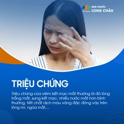 Viêm kết mạc mắt 2