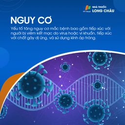 Viêm kết mạc mắt 4