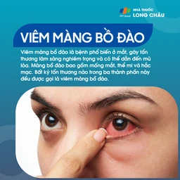 Viêm màng bồ đào 1