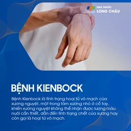 Bệnh kienbock 1