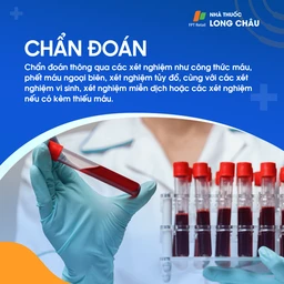 Giảm tiểu cầu miễn dịch 5