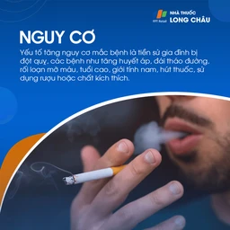 Hẹp động mạch cảnh 4