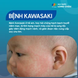 Bệnh Kawasaki – Bệnh viêm mạch máu ở trẻ em, gây sưng viêm động mạch vành và cản trở cung cấp oxy cho tim