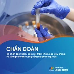 Rối loạn lipid máu 5