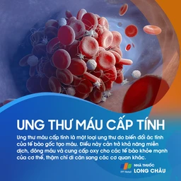 Ung thư máu cấp tính 1
