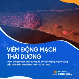 Viêm động mạch thái dương 1