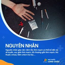 Viêm tắc tĩnh mạch 3