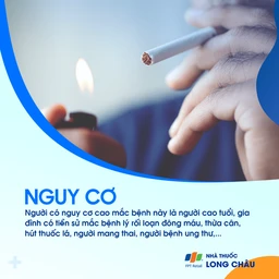 Viêm tắc tĩnh mạch 4