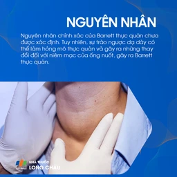 Barrett thực quản 3