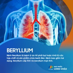 Bệnh Beryllium 1