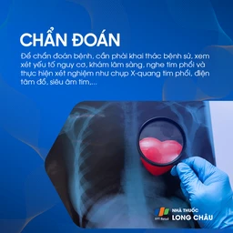 Phim X-quang tim phổi được soi qua kính lúp, minh họa các bước chẩn đoán bệnh mạch vành