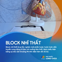 Block nhĩ thất 1