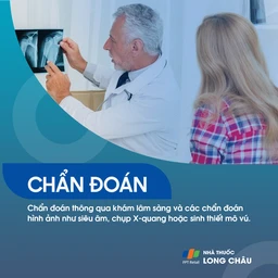 Bướu sợi tuyến 5