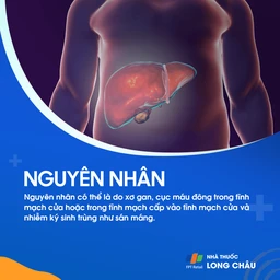 Giãn tĩnh mạch thực quản 3