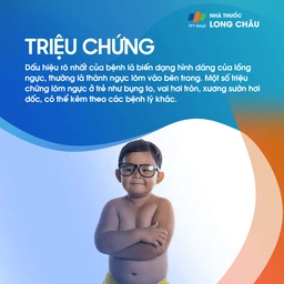 Lõm ngực bẩm sinh 2