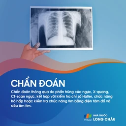 Ngực lỡm bẩm sinh 5