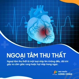 ngoại tâm thu thất, một loại rối loạn nhịp tim xuất phát từ thất