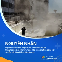 Nhiễm nấm Histoplasma 4