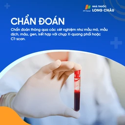 Nhiễm nấm Histoplasma 6