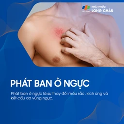 Phát ban ở ngực 1