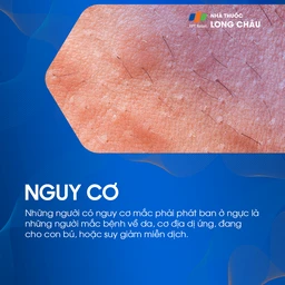 Phát ban ở ngực 4