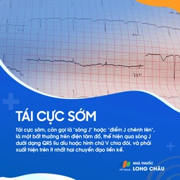 Tái cực sớm 1