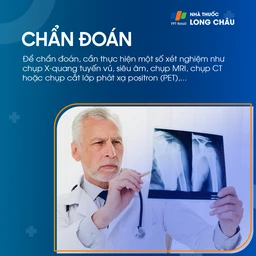 Ung thư vú tái phát 5