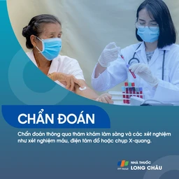 Viêm sụn sườn 5