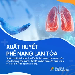 Xuất huyết phế nang lan tỏa 1