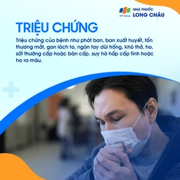 Xuất huyết phế nang lan tỏa 2