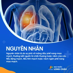 Xuất huyết phế nang lan tỏa 3