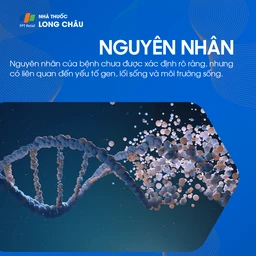 nguyên nhân gây ra tiểu đường tuýp 2, như lối sống ít vận động, chế độ ăn uống không lành mạnh và yếu tố di truyền