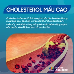 Là tình trạng mức cholesterol, đặc biệt LDL (“cholesterol xấu”) trong máu tăng cao, gây bám mảng vào thành mạch và ảnh hưởng tim mạch