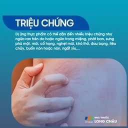 Dị ứng thực phẩm 2