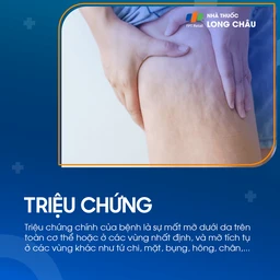 Loạn dưỡng mỡ 2