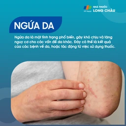 Ngứa da 1