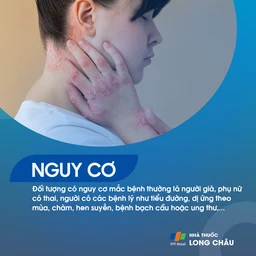 Ngứa da 4