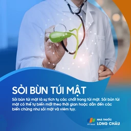 Sỏi bùn túi mật 1