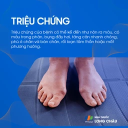 Tăng áp tĩnh mạch cửa 2