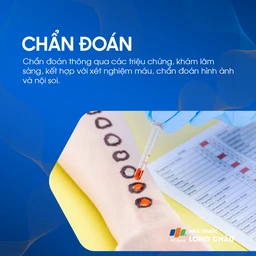 Tăng áp tĩnh mạch cửa 5