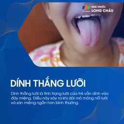 Dính thắng lưỡi 1
