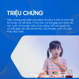 Dính thắng lưỡi 2
