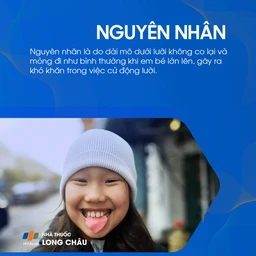 Dính thắng lưỡi 3