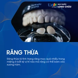 Răng thừa 1