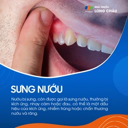 Sưng nướu 1