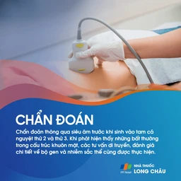 Tật không có hàm 5